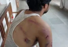 लिव-इन रिलेशनशिप में रह रहे जोड़े पर जानलेवा हमला गांव के सरपंच ने फाड़े महिला के कपड़े 1921113 untitled 209 copy