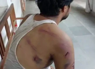 लिव-इन रिलेशनशिप में रह रहे जोड़े पर जानलेवा हमला गांव के सरपंच ने फाड़े महिला के कपड़े 1921113 untitled 209 copy