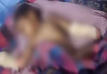 गर्म तेल में गिरी बच्ची हालत गंभीर। 2676542 untitled 26 copy