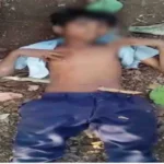 पेड़ से गिरा नाबालिग पेट में घुसी लकड़ी। 2761598 untitled 38 copy