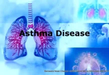 दमा के कारण, उपचार और रोकथाम के तरीके यह फेफड़े के वायुमार्ग से जुड़ी बीमारी है। Asthma Disease in Hindi
