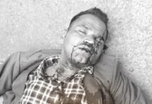 नया बस स्टैंड के सामने हुआ एक्सीडेंट रोडवेज बस ने मोटरसाइकिल चालक को मारी टक्कर जिसे उदयपुर रेफर किया गया। WhatsApp Image 2023 05 03 at 6.57.42 PM