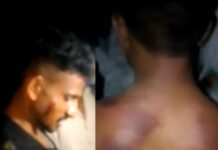 आदिवासी युवकों को बेरहमी से पीटा आरोपीयो पर तत्काल कार्यवाही करें BTP मांग करती हैं। 2ae84726 e04e 4f52 a48a 213ebc16b942